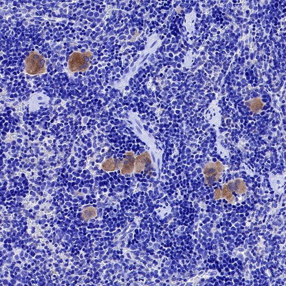 TGF beta 1 Recombinant Rabbit mAb (S-3204)