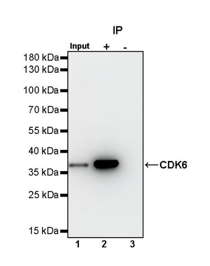 CDK6 Recombinant Rabbit mAb (S-1312-23)