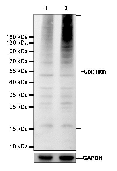 Ubiquitin Rabbit mAb (SDT-R095)