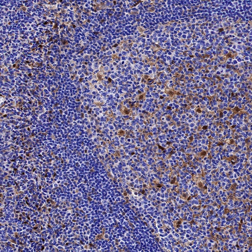 Galectin-1 Recombinant Rabbit mAb (S-1221-32）