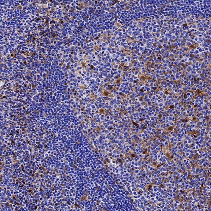 Galectin-1 Recombinant Rabbit mAb (S-1221-32）