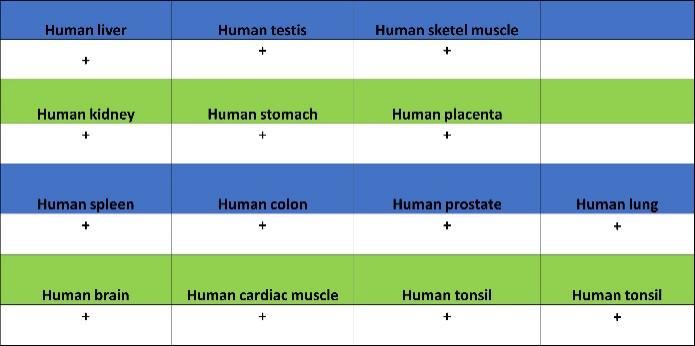 Superoxide Dismutase 1 Recombinant Rabbit mAb (S-1537-39)