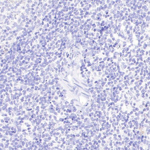 Mouse mAb IgM, κ Isotype Control (S-844-28)