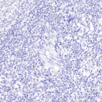 Mouse mAb IgM, κ Isotype Control (S-844-28)
