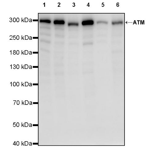 ATM Recombinant Rabbit mAb (S-2178-4)