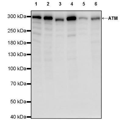 ATM Recombinant Rabbit mAb (S-2178-4)