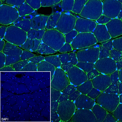 Dystrophin Recombinant Rabbit mAb (S-090-327)