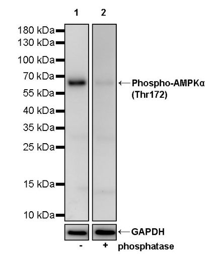 Phospho-AMPKα (Thr172) Recombinant Rabbit mAb (S-2216-10)