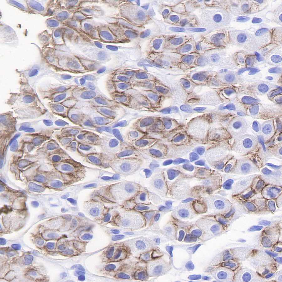 CAIX Recombinant Rabbit mAb (SDT-356-21)