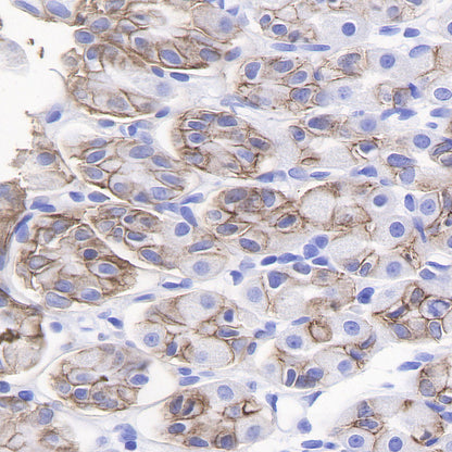 CAIX Recombinant Rabbit mAb (SDT-356-21)
