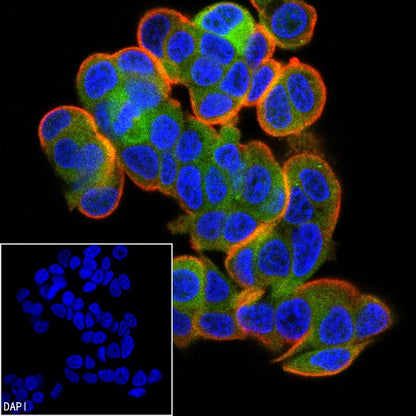 Phospho-ULK1 (Ser757) Recombinant Rabbit mAb (S-3495)