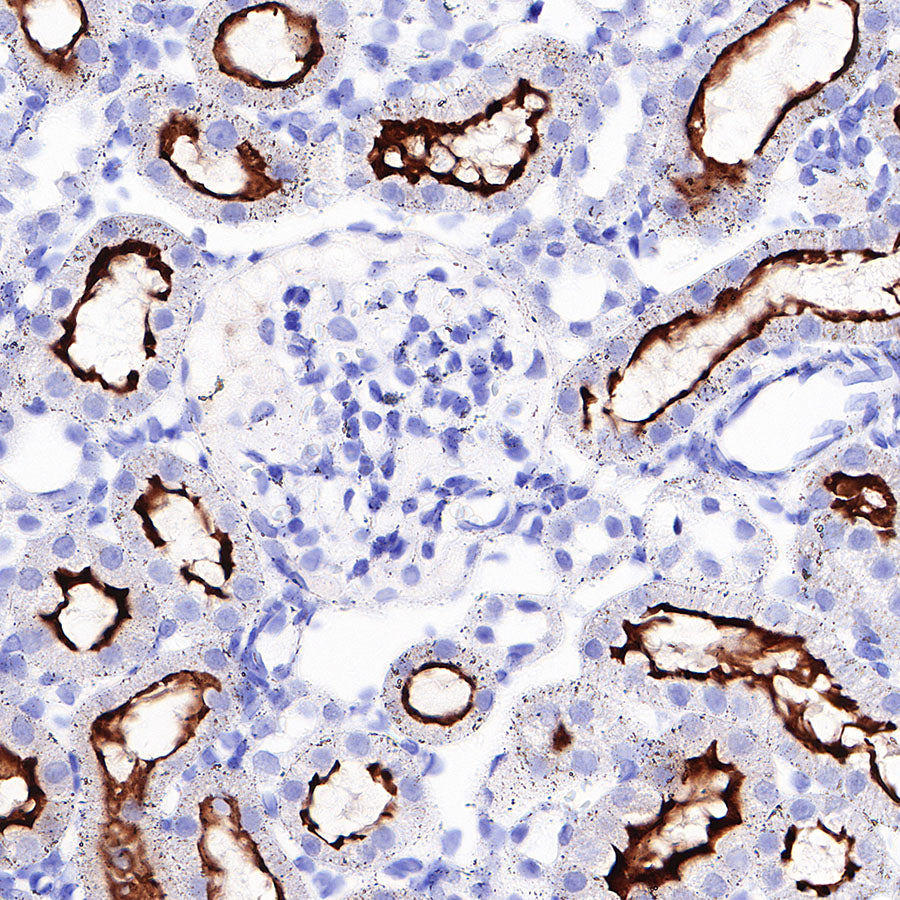 CD13 Recombinant Rabbit mAb (SDT-R162)