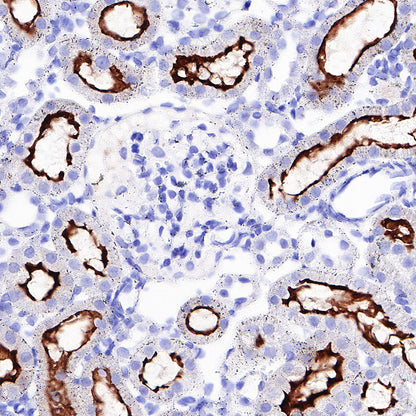 CD13 Recombinant Rabbit mAb (SDT-R162)