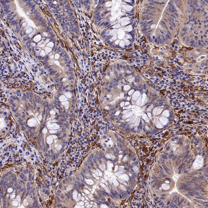 DAB2 Recombinant Rabbit mAb (S-2131-55)