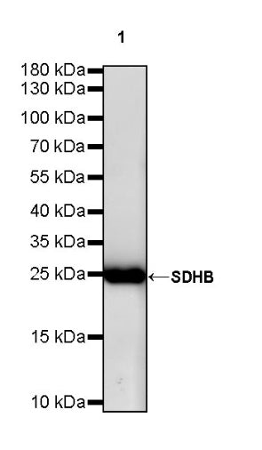 SDHB Recombinant Rabbit mAb (SDT-1162-2)