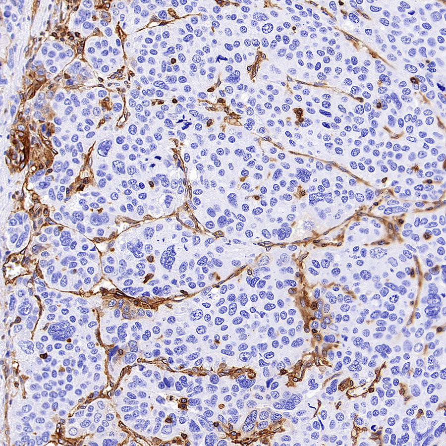 HLA-ABC Recombinant Rabbit mAb (S-3995-2)