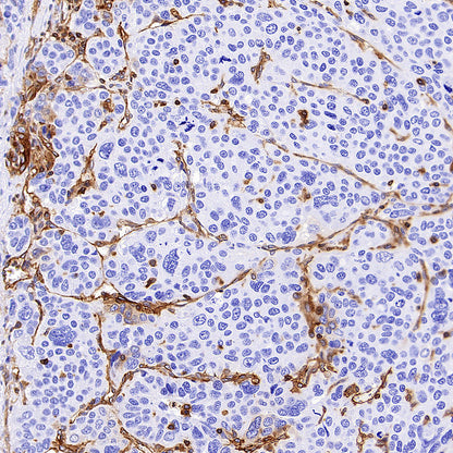 HLA-ABC Recombinant Rabbit mAb (S-3995-2)
