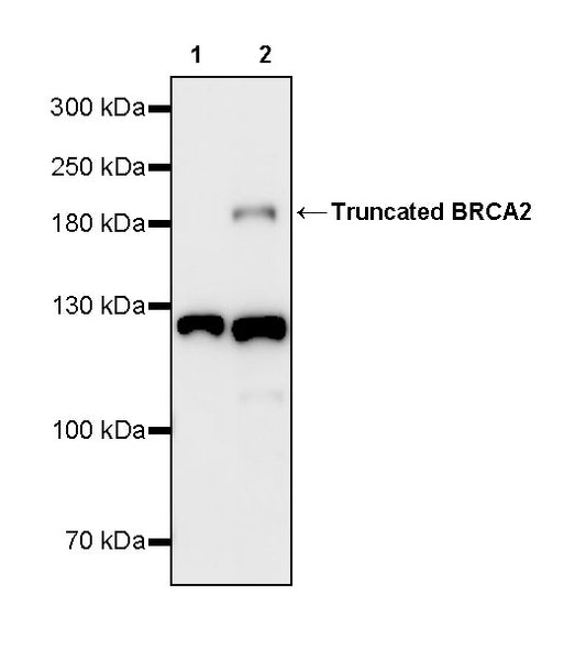 BRCA2 Recombinant Rabbit mAb (S-5306)