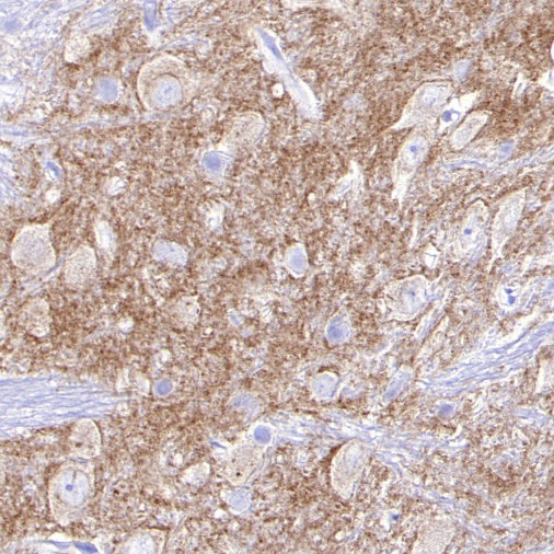 GABRD Recombinant Rabbit mAb (S-1584-162)