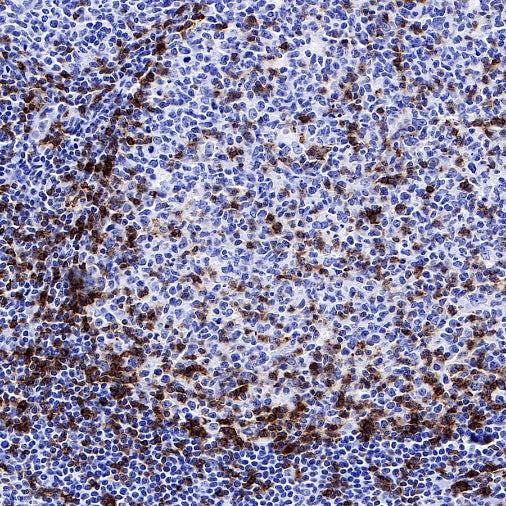 Mouse Anti-Human CD45RO Antibody (UCHL1)