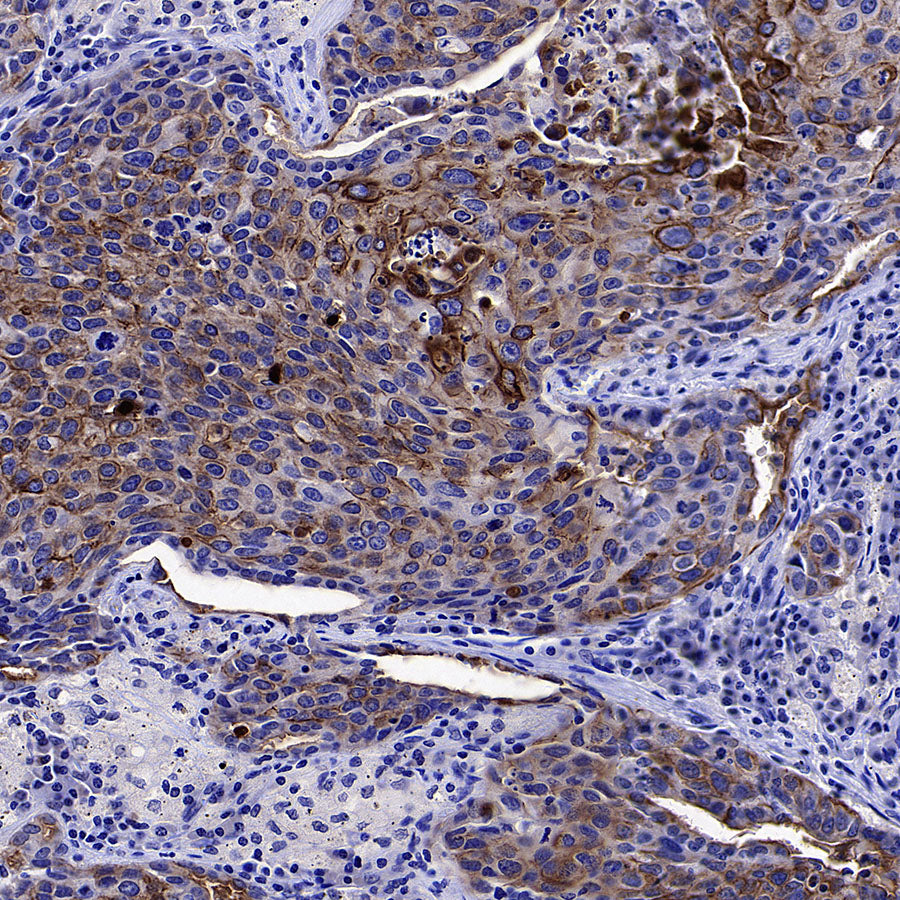 GPRC5A Recombinant Rabbit mAb (S-4383-15)
