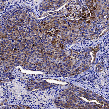 GPRC5A Recombinant Rabbit mAb (S-4383-15)