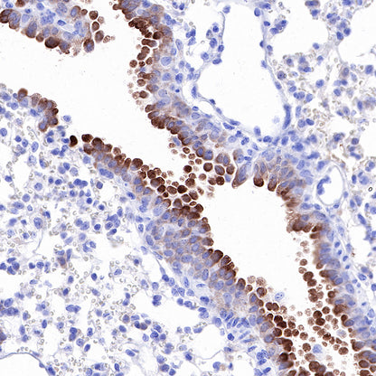 iNOS Recombinant Rabbit mAb (SDT-R131)