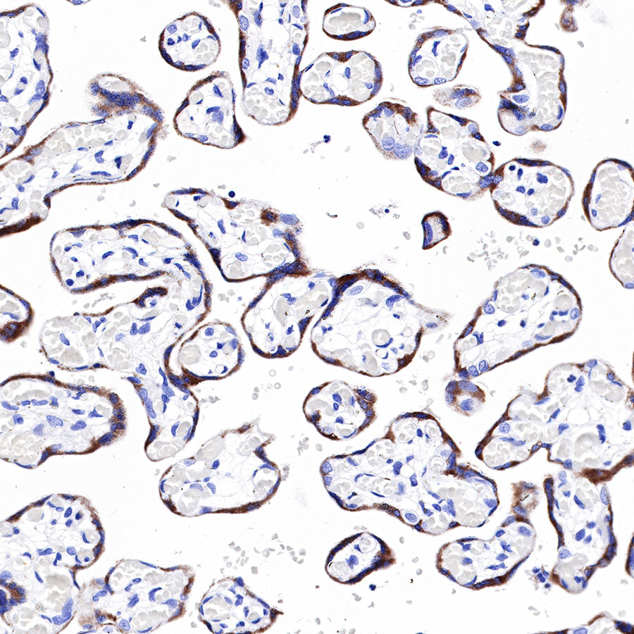 PAPP-A Recombinant Rabbit mAb (SDT-226-46)