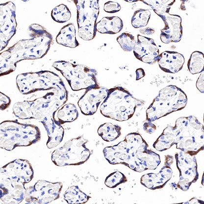 PAPP-A Recombinant Rabbit mAb (SDT-226-46)
