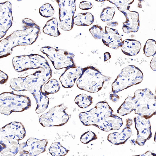 PAPP-A Recombinant Rabbit mAb (SDT-226-46)