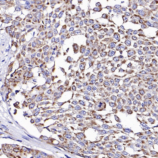 OPA1 Recombinant Rabbit mAb (S-2189-65)