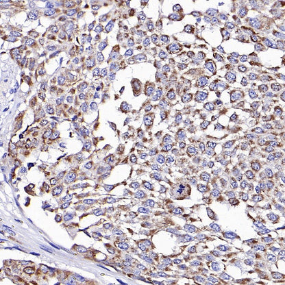 OPA1 Recombinant Rabbit mAb (S-2189-65)