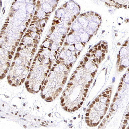 NR1D1 + NR1D2 / RVR Recombinant Rabbit mAb (S-5962)