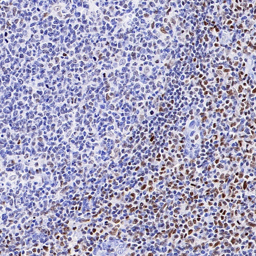 Runx3 Recombinant Rabbit mAb (S-R356)