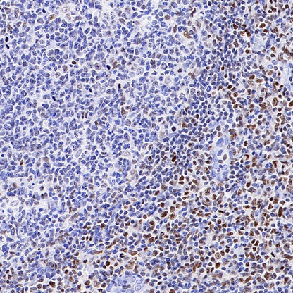 Runx3 Recombinant Rabbit mAb (S-R356)