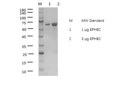 EPHB2 Protein