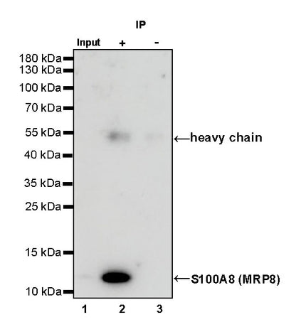 S100A8 (MRP8) Recombinant Rabbit mAb (SDT-059-28)