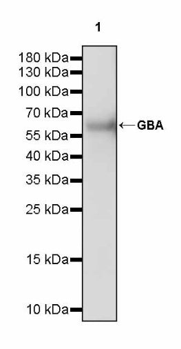 GBA Recombinant Rabbit mAb (S-3211-14)