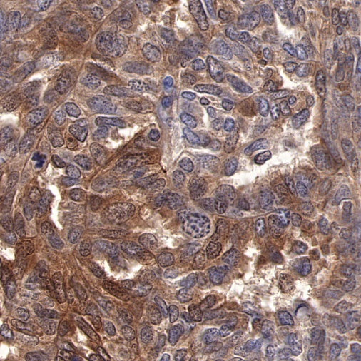 ST13 Recombinant Rabbit mAb (S-661-38)