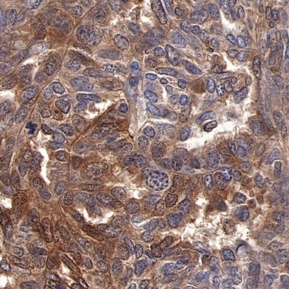 ST13 Recombinant Rabbit mAb (S-661-38)