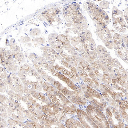Integrin beta 4 Recombinant Rabbit mAb (S-1625-170)