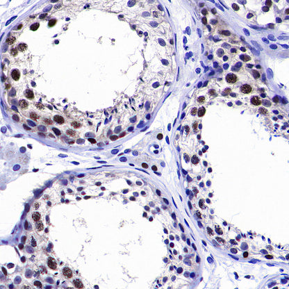 PCNA Recombinant Rabbit mAb (S-5313)