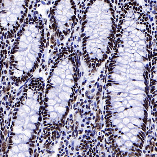 PELP1 Recombinant Rabbit mAb (S-756-22)