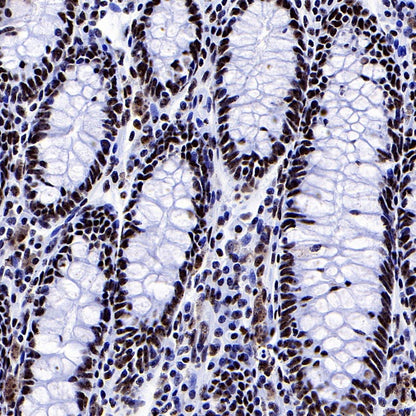 PELP1 Recombinant Rabbit mAb (S-756-22)