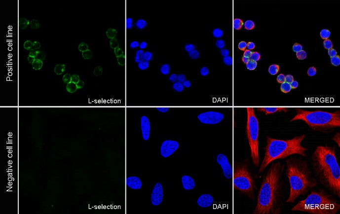 L-selectin Recombinant Rabbit mAb (S-1164-30)