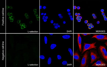 L-selectin Recombinant Rabbit mAb (S-1164-30)