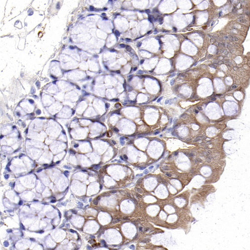 S-RMab® Caspase-7 Recombinant Rabbit mAb (S-1539-42)