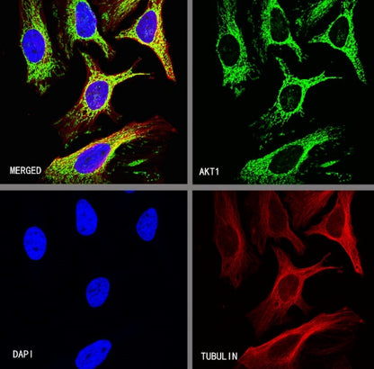 AKT1 Recombinant Rabbit mAb (S-R364)