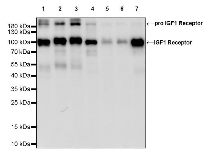 IGF1 Receptor Recombinant Rabbit mAb (S-1617-146)