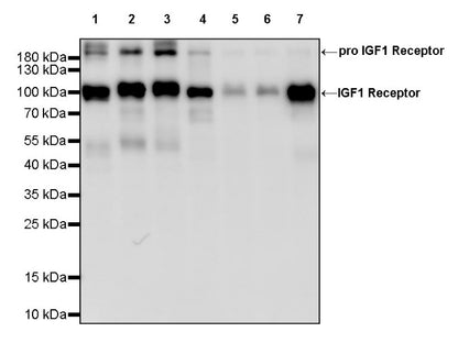 IGF1 Receptor Recombinant Rabbit mAb (S-1617-146)